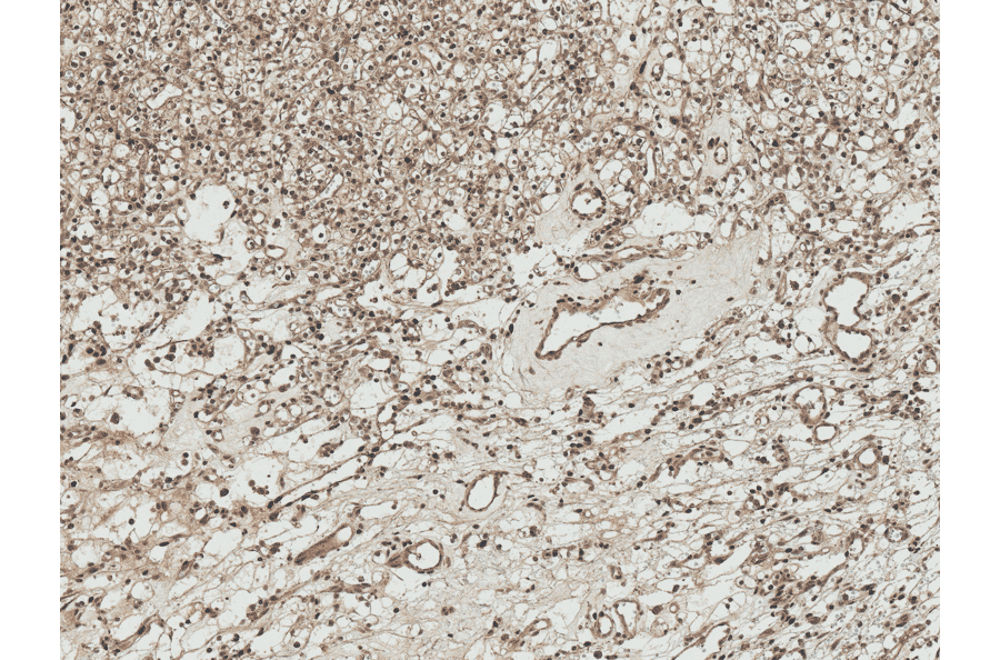 Immunohistochemistry - Anti-ATG7 Antibody (A305057) - Antibodies.com