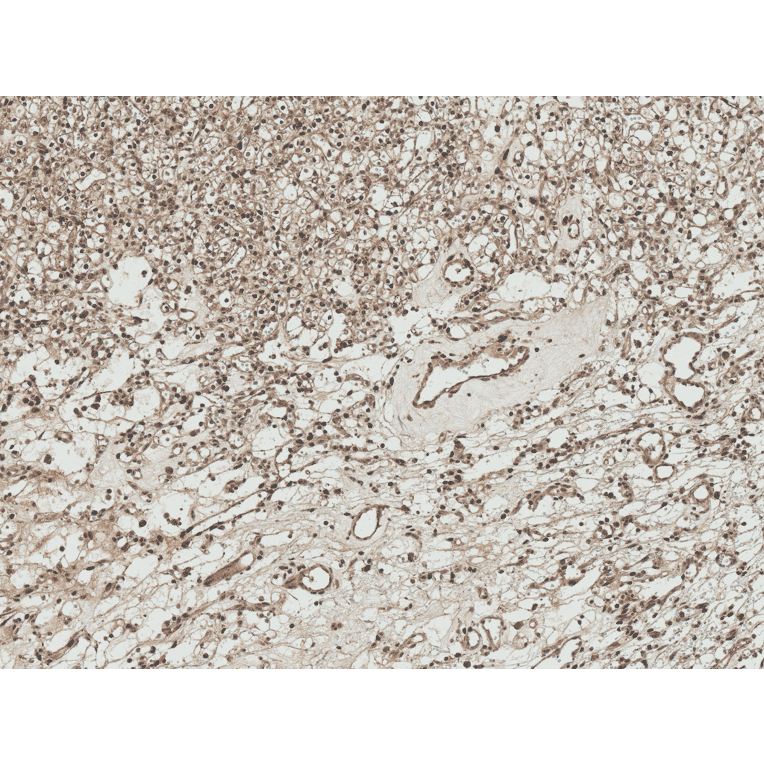 Immunohistochemistry - Anti-ATG7 Antibody (A305057) - Antibodies.com