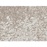 Immunohistochemistry - Anti-ATG7 Antibody (A305057) - Antibodies.com