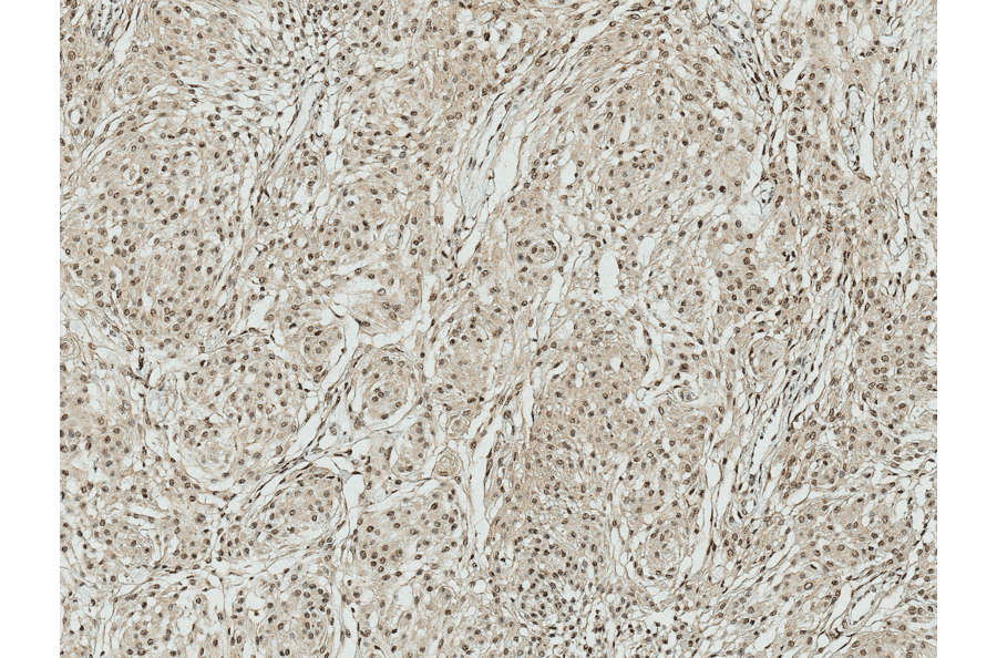 Immunohistochemistry - Anti-ATG7 Antibody (A305058) - Antibodies.com