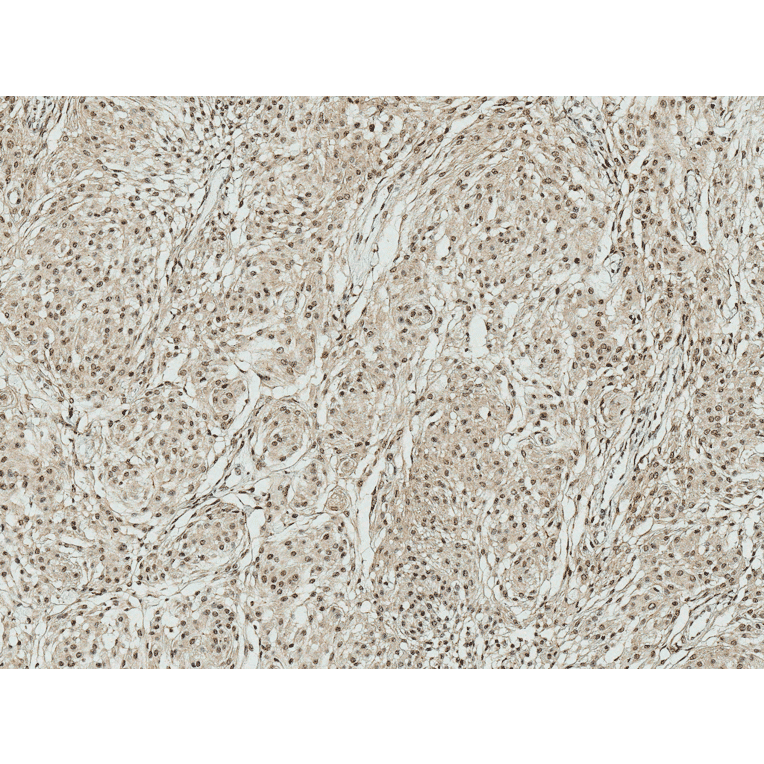 Immunohistochemistry - Anti-ATG7 Antibody (A305058) - Antibodies.com