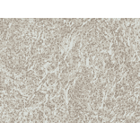 Immunohistochemistry - Anti-ATG7 Antibody (A305058) - Antibodies.com
