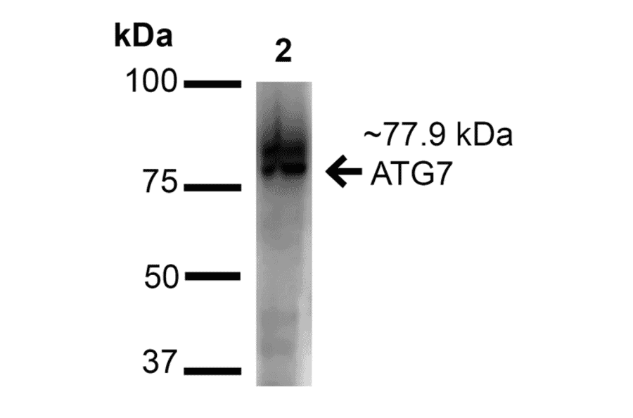 Western Blot - Anti-ATG7 Antibody (A305058) - Antibodies.com