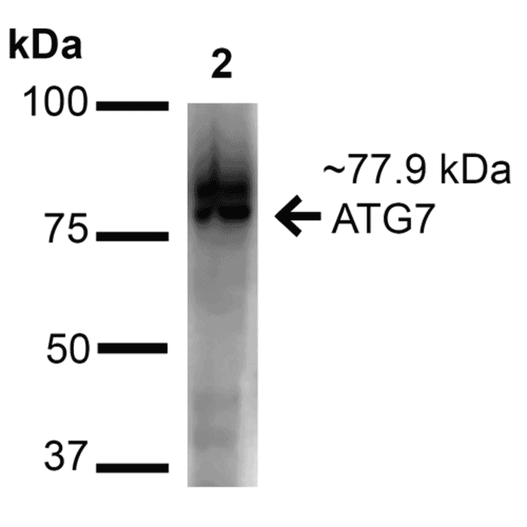 Western Blot - Anti-ATG7 Antibody (A305058) - Antibodies.com
