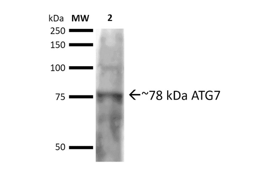 Western Blot - Anti-ATG7 Antibody (A305058) - Antibodies.com