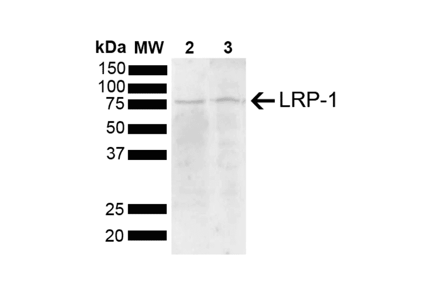 Western Blot - Anti-LRP1 Antibody (A305059) - Antibodies.com