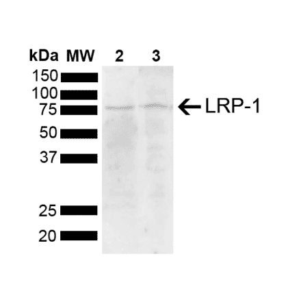 Western Blot - Anti-LRP1 Antibody (A305059) - Antibodies.com