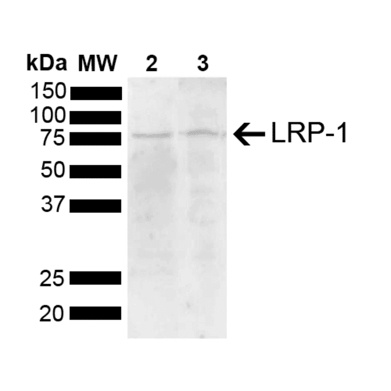 Western Blot - Anti-LRP1 Antibody (A305059) - Antibodies.com
