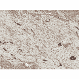 Immunohistochemistry - Anti-LRP1 Antibody (A305059) - Antibodies.com