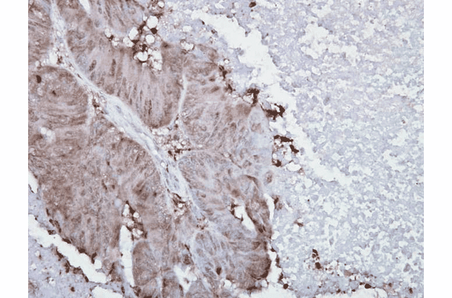 Immunohistochemistry - Anti-HSP90 alpha Antibody [Hyb-K41009] (A305061) - Antibodies.com