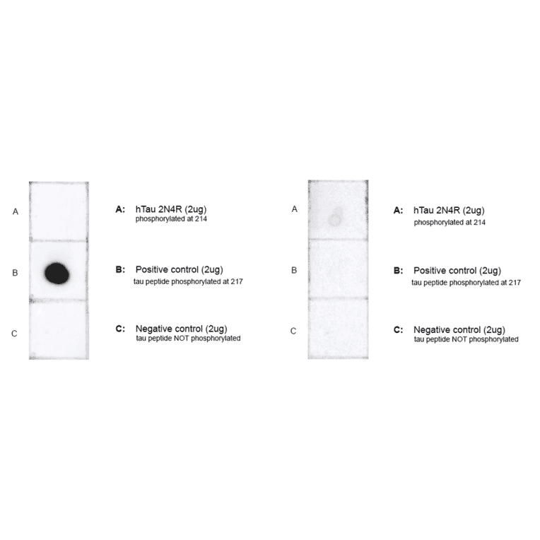 Dot Blot - Anti-Tau (phospho Thr217) Antibody [15B7] (A305063) - Antibodies.com