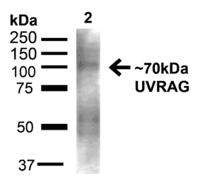 Western Blot - Anti-UVRAG Antibody (A305064) - Antibodies.com