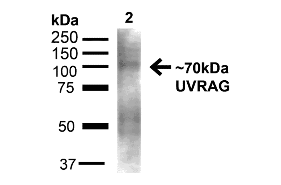 Western Blot - Anti-UVRAG Antibody (A305064) - Antibodies.com