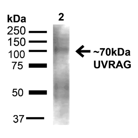 Western Blot - Anti-UVRAG Antibody (A305064) - Antibodies.com