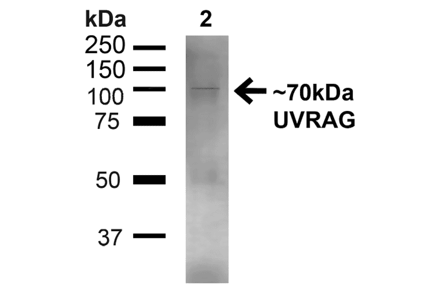 Western Blot - Anti-UVRAG Antibody (A305064) - Antibodies.com