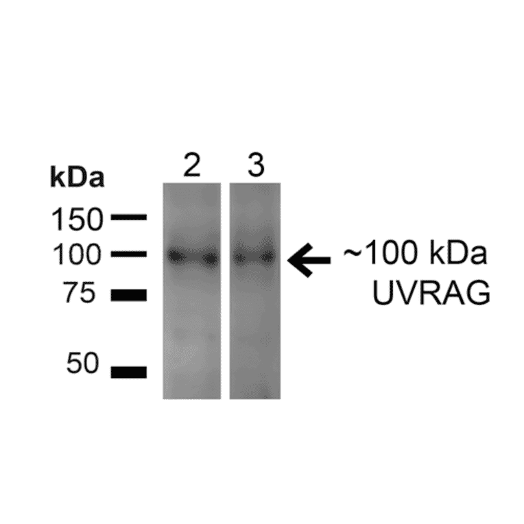 Western Blot - Anti-UVRAG Antibody (A305065) - Antibodies.com