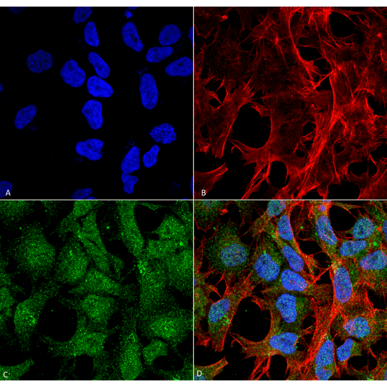 Immunocytochemistry/Immunofluorescence - Anti-UVRAG Antibody (A305065) - Antibodies.com