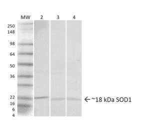 Western Blot - Anti-Superoxide Dismutase 1 Antibody (A305066) - Antibodies.com