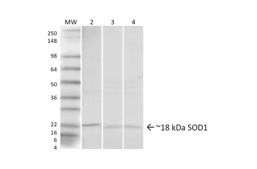 Western Blot - Anti-Superoxide Dismutase 1 Antibody (A305066) - Antibodies.com