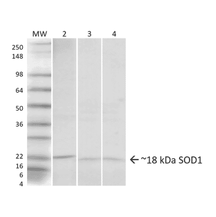 Western Blot - Anti-Superoxide Dismutase 1 Antibody (A305066) - Antibodies.com
