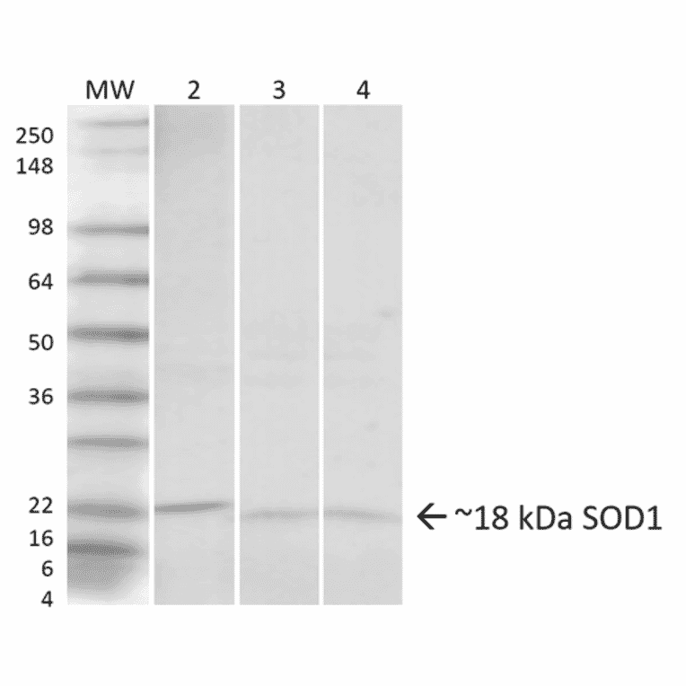 Western Blot - Anti-Superoxide Dismutase 1 Antibody (A305066) - Antibodies.com