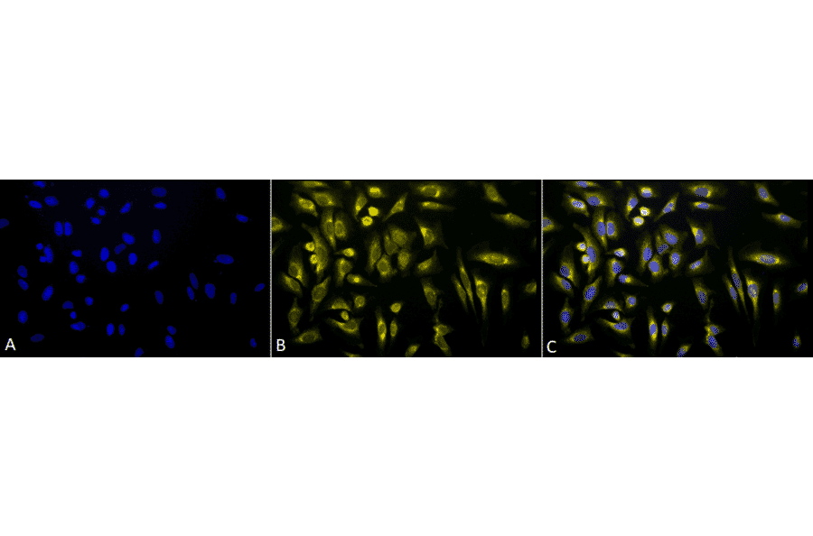 Immunocytochemistry/Immunofluorescence - Anti-KDEL Antibody (A305067) - Antibodies.com