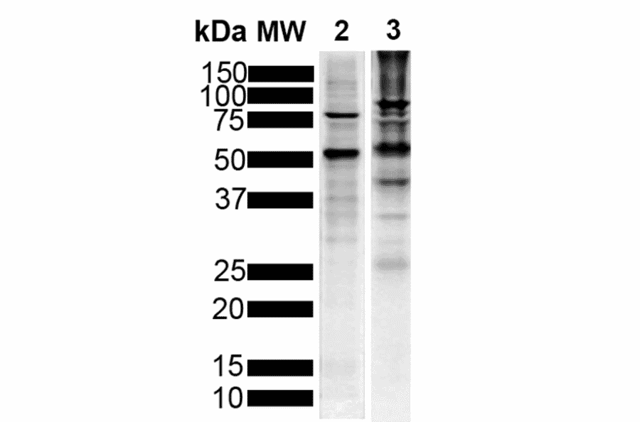 Western Blot - Anti-Tau Antibody [1D5] (A305068) - Antibodies.com