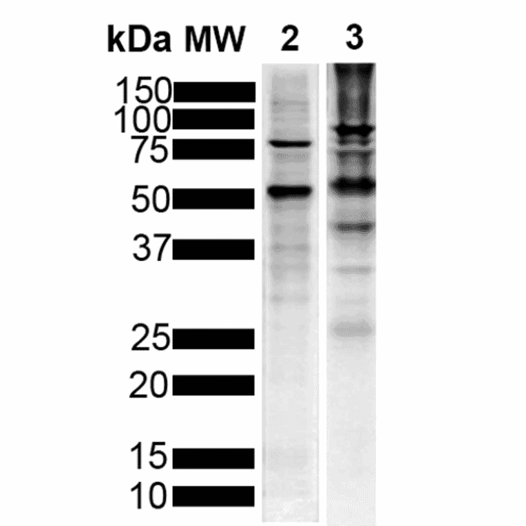 Western Blot - Anti-Tau Antibody [1D5] (A305068) - Antibodies.com