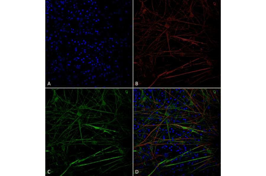 Immunocytochemistry/Immunofluorescence - Anti-Tau Antibody [1D5] (A305068) - Antibodies.com