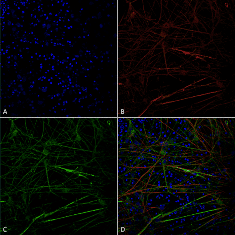 Immunocytochemistry/Immunofluorescence - Anti-Tau Antibody [1D5] (A305068) - Antibodies.com