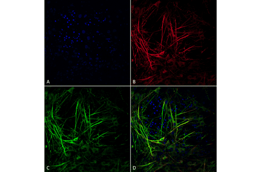 Immunocytochemistry/Immunofluorescence - Anti-Tau Antibody [3D4] (A305069) - Antibodies.com