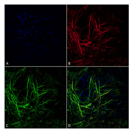 Immunocytochemistry/Immunofluorescence - Anti-Tau Antibody [3D4] (A305069) - Antibodies.com