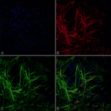 Immunocytochemistry/Immunofluorescence - Anti-Tau Antibody [3D4] (A305069) - Antibodies.com