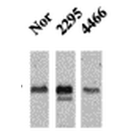 Western Blot - Anti-CaMKII Antibody [22B1] (A305070) - Antibodies.com