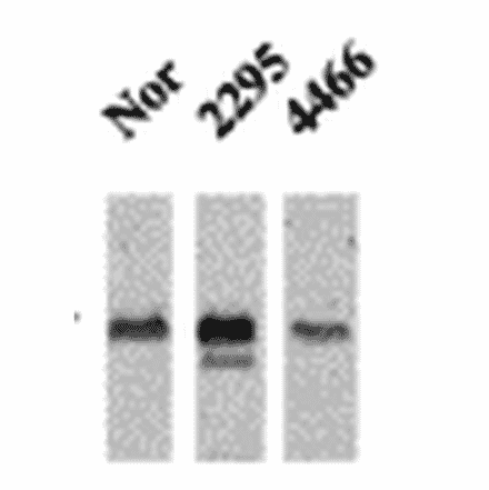 Western Blot - Anti-CaMKII Antibody [22B1] (A305070) - Antibodies.com