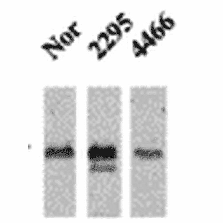 Western Blot - Anti-CaMKII Antibody [22B1] (A305070) - Antibodies.com