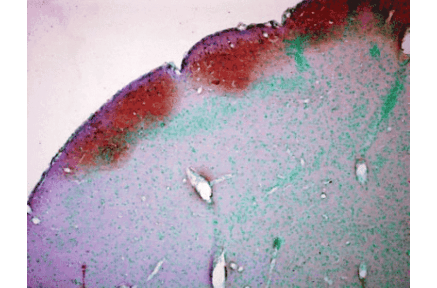 Immunohistochemistry - Anti-CaMKII Antibody [22B1] (A305070) - Antibodies.com