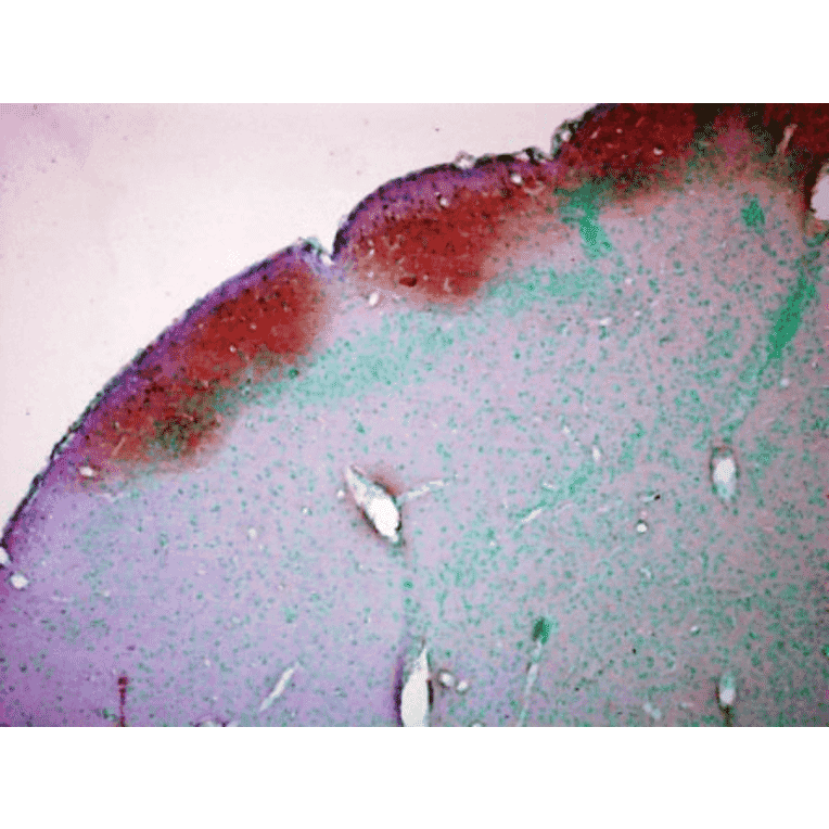 Immunohistochemistry - Anti-CaMKII Antibody [22B1] (A305070) - Antibodies.com