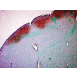 Immunohistochemistry - Anti-CaMKII Antibody [22B1] (A305070) - Antibodies.com