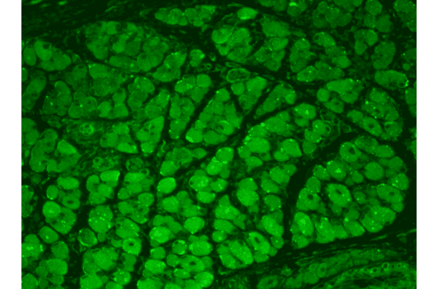 Immunohistochemistry - Anti-CaMKII Antibody [22B1] (A305070) - Antibodies.com