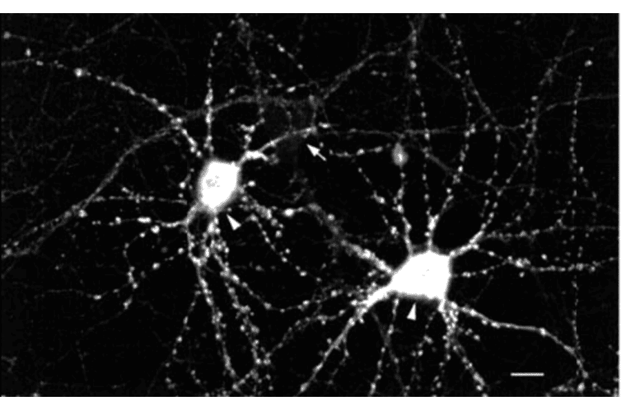 Immunocytochemistry/Immunofluorescence - Anti-CaMKII Antibody [22B1] (A305070) - Antibodies.com