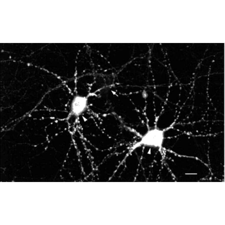 Immunocytochemistry/Immunofluorescence - Anti-CaMKII Antibody [22B1] (A305070) - Antibodies.com