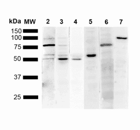 Western Blot - Anti-KDEL Antibody [1F2] (A305071) - Antibodies.com