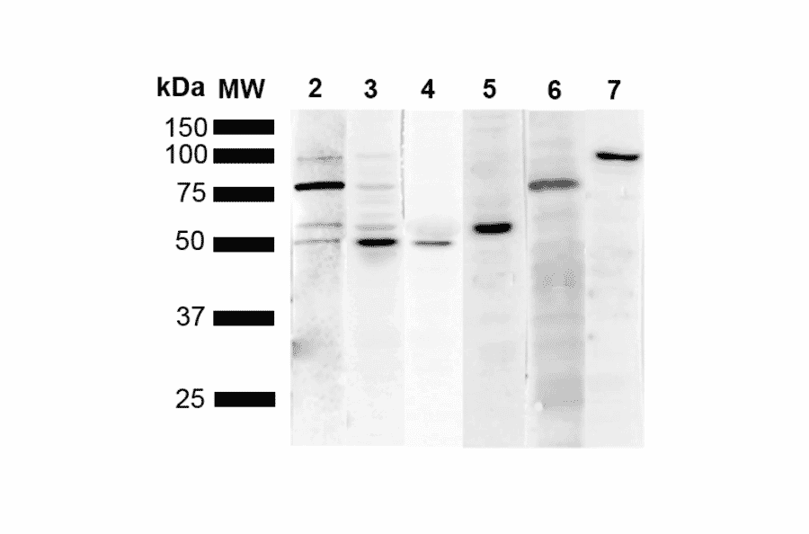 Western Blot - Anti-KDEL Antibody [1F2] (A305071) - Antibodies.com