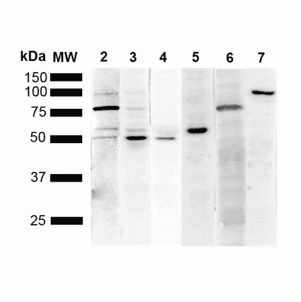 Western Blot - Anti-KDEL Antibody [1F2] (A305071) - Antibodies.com