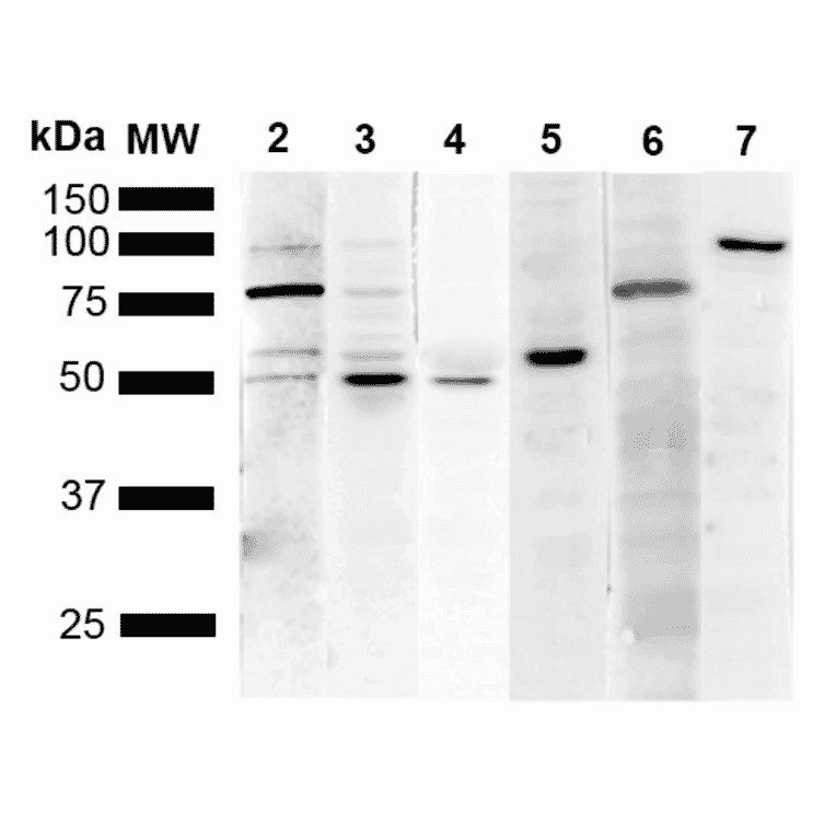 Western Blot - Anti-KDEL Antibody [1F2] (A305071) - Antibodies.com