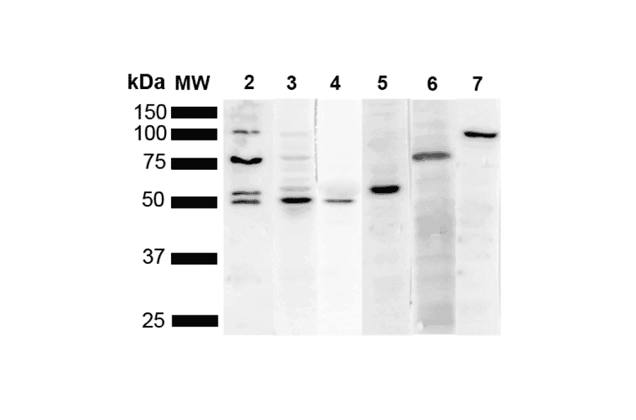 Western Blot - Anti-KDEL Antibody [2C1] (A305072) - Antibodies.com