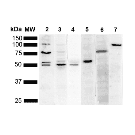 Western Blot - Anti-KDEL Antibody [2C1] (A305072) - Antibodies.com