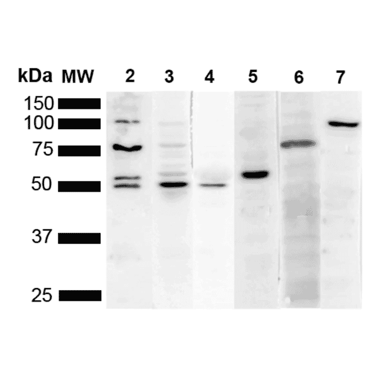 Western Blot - Anti-KDEL Antibody [2C1] (A305072) - Antibodies.com