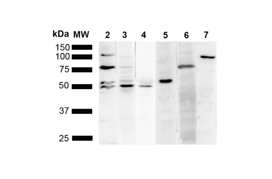 Western Blot - Anti-KDEL Antibody [2D6] (A305073) - Antibodies.com